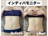 【数名限定】《インディバモニター30分＋リンパドレナージュ10分　￥3300》