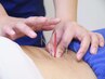 鍼灸施術