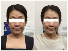 シンメトリー 麻布十番/Before/After