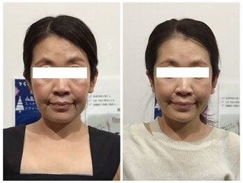 シンメトリー 麻布十番/Before/After