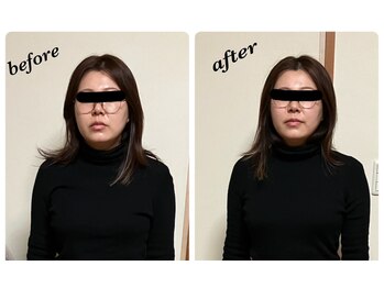 鍼灸庵利央/お身体のむくみも取れて◎