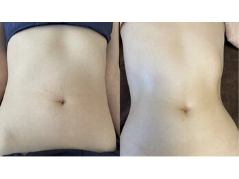 ソルナ 吉塚(SOLUNA)/リンパトリートメント・ヘッド