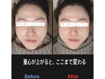 美容矯正サロン レレポノ(LELEPONO)/