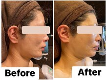 イオム ビューティワーク(IOM BEAUTY WORK)/