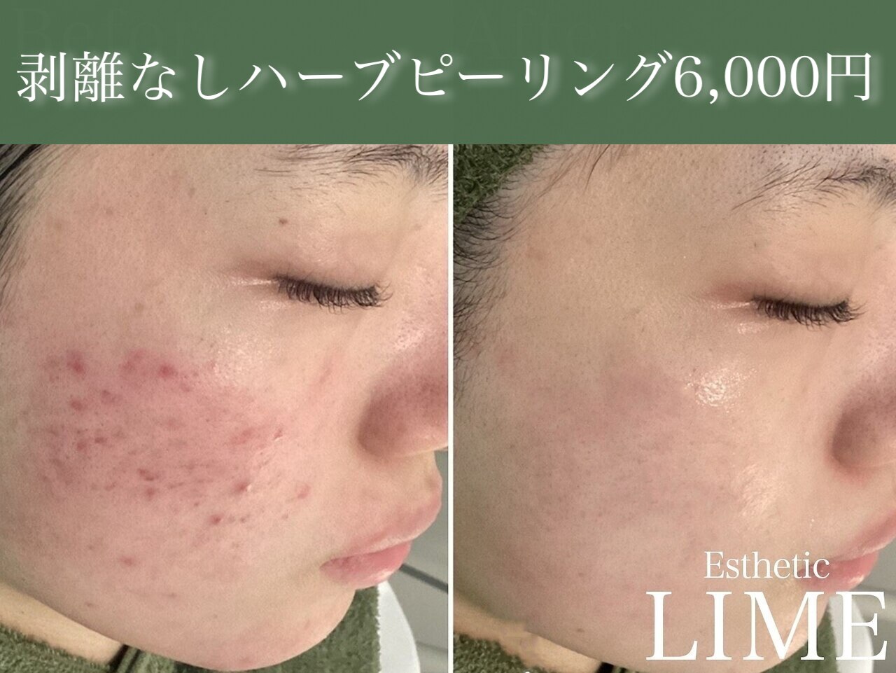 ライム 錦糸町(LIME)｜ホットペッパービューティー