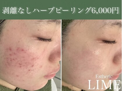 ライム 錦糸町(LIME)の写真