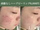 ライム 錦糸町(LIME)の写真
