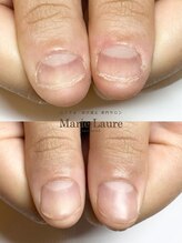 マリーロール 梅田店(Marie Laure)/自爪育成/深爪矯正/ネイルケア