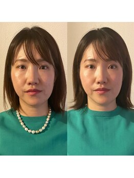 ラ アクサル(la.akthar)/小顔 全身 骨格矯正 整体