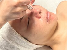 ベルドア(Bell Door)/【毛穴吸引】