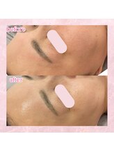 シャルム(Charme)/お客様のbefore after