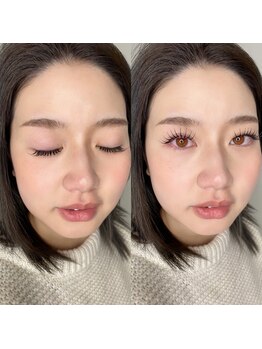 イチ(ichi)/エクステ &nbsp;&nbsp;100