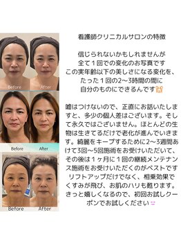 クリニカルスイート エーアール(Clinical sweet.ar)/たった１回での変化