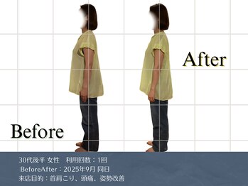 リビット 等々力(Rebit)/BeforeAfter,首肩こり,頭痛