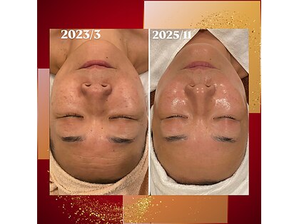 トータルエステティック ジョワイユ(JOYEUX)の写真