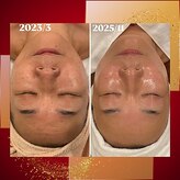 トータルエステティック ジョワイユ(JOYEUX)