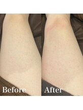 ジョエルワックス 沖縄那覇店(JOELLE WAX)/両脚チクチク感なし！ツル肌♪