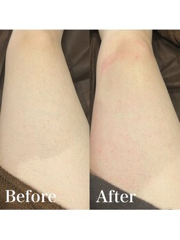 ジョエルワックス 沖縄那覇店(JOELLE WAX)/両脚チクチク感なし！ツル肌♪