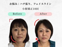 美容整体 ウェリナ 蟹江院/小顔矯正/骨盤矯正/痩身整体