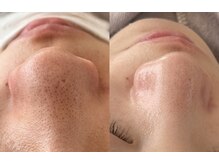 アトリエドゥアージュ(Atelier de age)