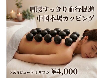 エスアンドエス(S&S)の写真