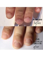 リノール(Linol)/