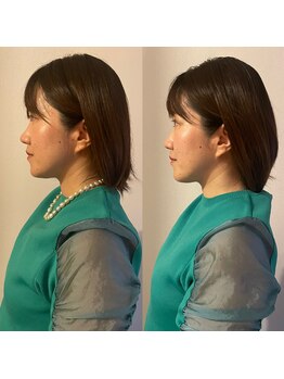 ラ アクサル(la.akthar)/小顔 全身 骨格矯正 整体