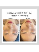 ポムハヌル(pom.haneul)/韓国肌管理室