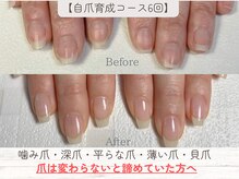 ネーム(name)の雰囲気（【4ヶ月】で美爪へ♪自爪育成／深爪改善コース）