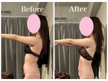 ハリムーン 仙台(harimoon)/お腹ビフォーアフター