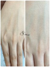 サナ 久が原 千鳥町(S’ana)/ハーブピーリング