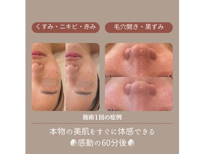 シルク(Silk)の写真
