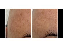 リアム(Liam)/　1ヶ月ごの変化→