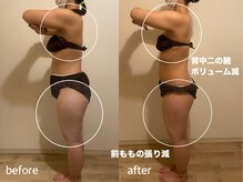 リラクゼーションエステ アジュール(Azur)/【施術12回】