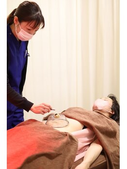 共立総合整骨院 町田鶴川院/心地よい温かさのお灸です!