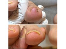 アイリー(IRIE)の雰囲気(巻き爪はもちろん!タコ・魚の目などのお悩みもお任せ下さい!)