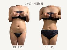 サロンドベル(salon de Belle)の雰囲気（60分施術を4回。ラジオ波/キャビテーション/吸引/EMS）