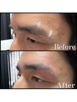 眉毛男子 新宿店/お客様の施術例