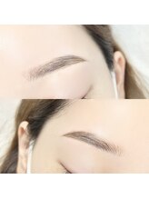 リラ(Lyra)/ブロウリフト