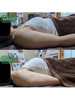 スノードロップ(snowdrop)/1回での変化