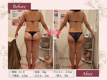 リムサロン(RIMSALON)/