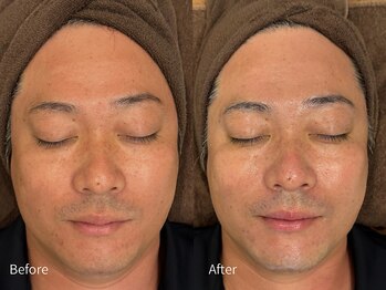 アウラ 小杉店(AULA)/ララピール☆