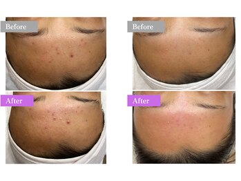 ホワイトワックス 堺東店(WHITE WAX)/★Before/After★