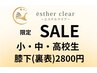 【小・中・高校生限定】学生脱毛応援割引！膝下(裏表)2,800円！