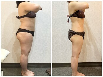 ウェリナ平和堂長久手院/小顔矯正/骨盤矯正/美脚サロン