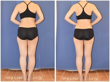 アンシャンテ姫路/20代　ブライダル 姫路エステ