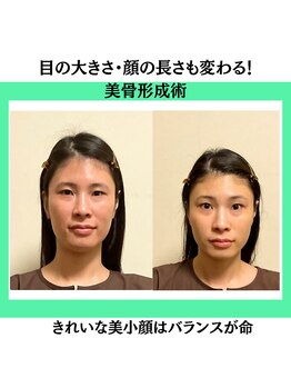 シエル(CIEL)/美人顔はバランスが大事！