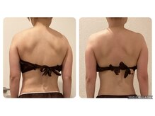 ボーテ(beaute)/【姿勢改善】