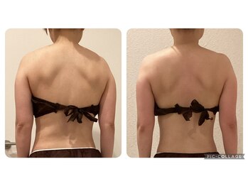 ボーテ(beaute)/【姿勢改善】