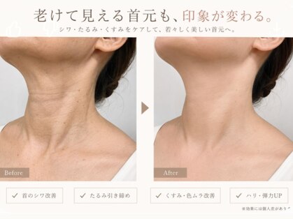 【たるみケア・シミケア・毛穴】エイジングケアAreum(アルム)戸塚の写真